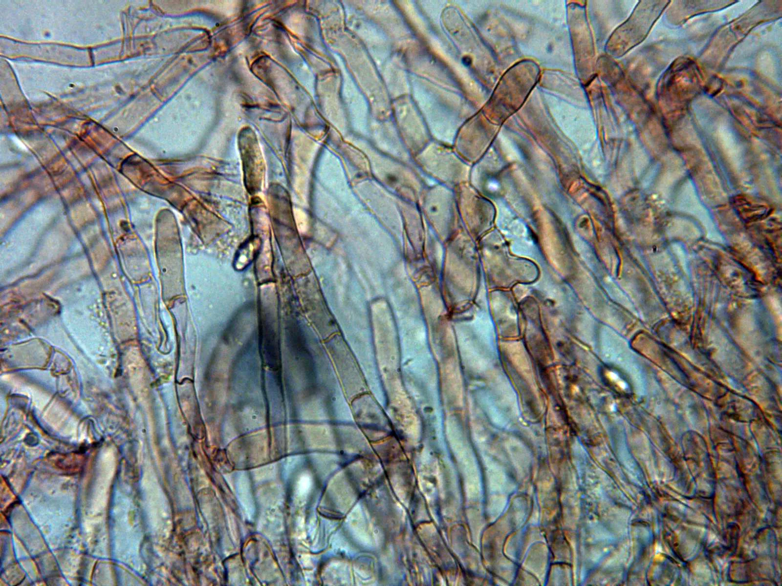 Microscopía de Sowerbyella imperialis - 10 - Pelos externos x 400